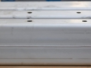 Plasma keyhole geeft Deprest nieuw mogelijkheden: image 1